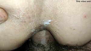 Anal masturbation dilator medical anal speculum