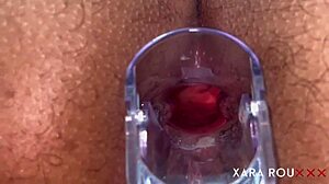 Anal vision speculum