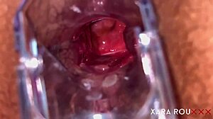 Anal vision speculum