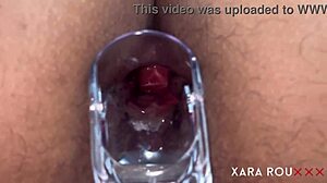 Anal vision speculum