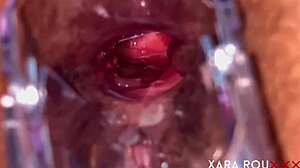 Anal vision speculum