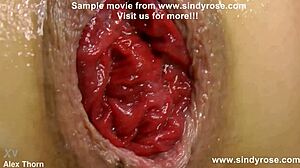 Sindy Rose Endures Extreme Anal Fisting On Kitchen Countertop Leading To Prolapse