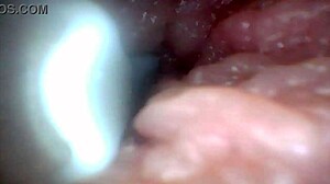 Penis Endoscope View!