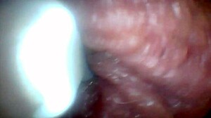 Penis Endoscope View!