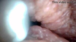 Penis Endoscope View!