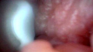 Penis Endoscope View!