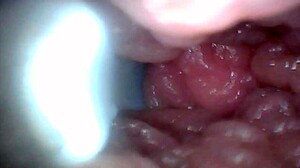 Penis Endoscope View!