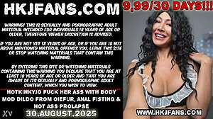 Ass Fisting Prolapse