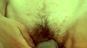 prolapse anal fisting